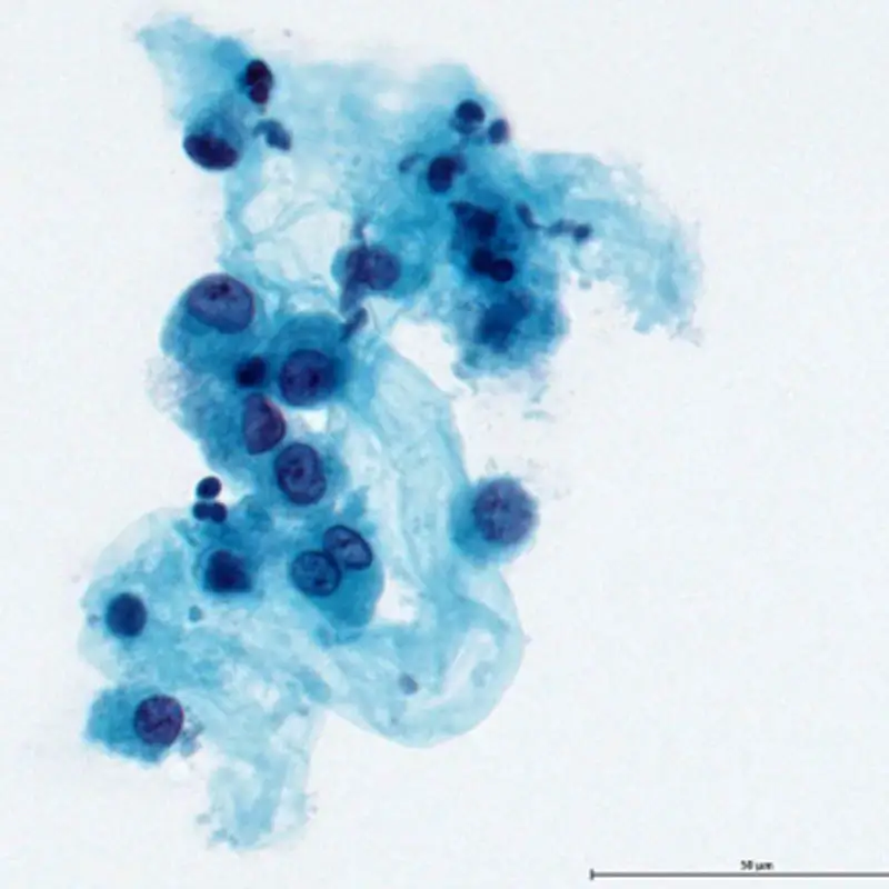 Non-GYN BCF Stain