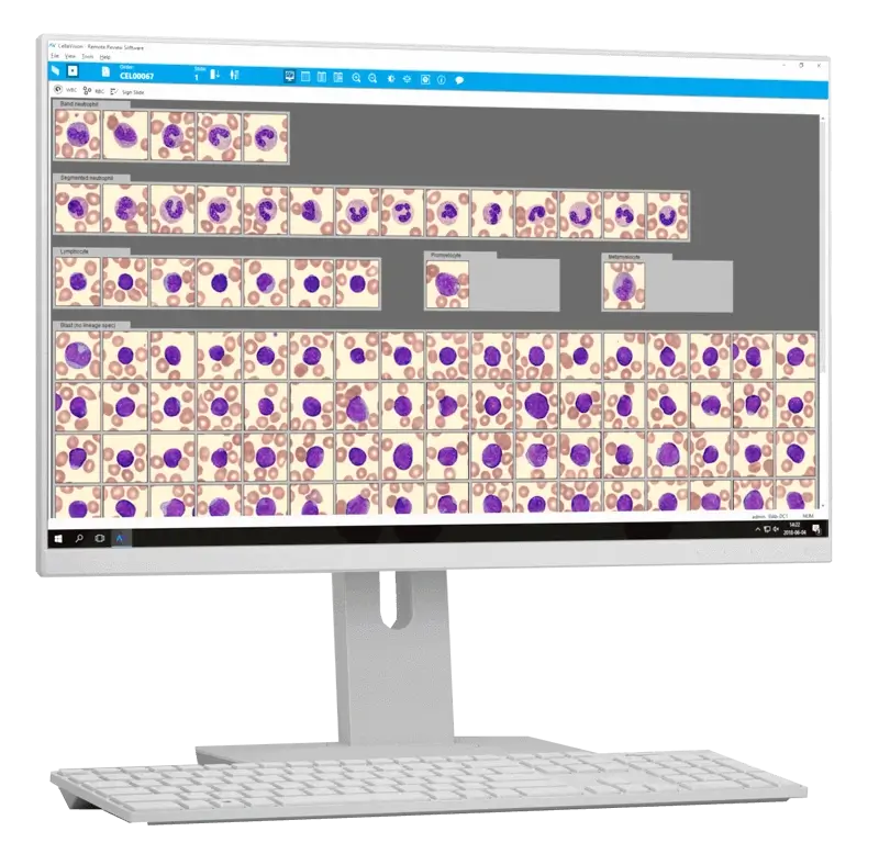 CellaVision&reg; Peripheral Blood Application