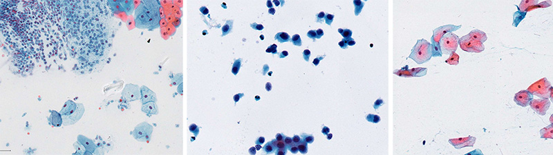 Aerospray® Cytology Digital Slide Library